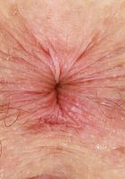 Apricot Pitts Upskirt Spreads, Apricot Pitts (apr024) ATK Natural & Hairy: Apricot Pitts (Apricot Pitts Upskirt Spreads)