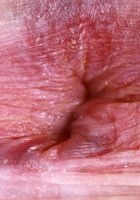 ATK Galleria: Avery Wilds (Avery Wilds can really stretch)