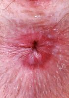 ATK Petites: Big Eyes (Big Eyes might be a cow)