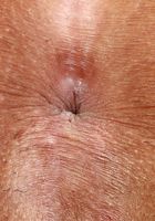 Binky Beaz Spreads her Holes, Binky Beaz (bin002) ATK Petites: Binky Beaz (Binky Beaz Spreads her Holes)