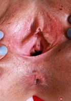 ATK Galleria: Dez Hansen (Dez Hansen takes off a bikini)