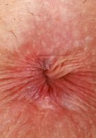 Emma Jade Outdoor Exposure, Emma Jade (emm037) ATK Petites: Emma Jade (Emma Jade Outdoor Exposure)