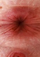 Emma Rosie Spreads her Toes and Ass, Emma Rosie (emm038) ATK Petites: Emma Rosie (Emma Rosie Spreads her Toes and Ass)