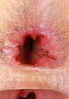 Fiona Frost Huge Gaping Holes, Fiona Frost (fio011) ATK Galleria: Fiona Frost (Fiona Frost Huge Gaping Holes)