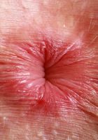 Fiona Peaches from ATK Natural & Hairy