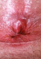 ATK Natural & Hairy: Gigi (Gigi is all in pink)