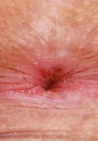 Lana Smalls Gaping holes, Lana Smalls (lan037) ATK Galleria: Lana Smalls (Lana Smalls Gaping holes)