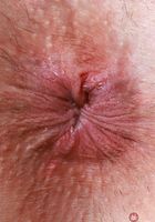 ATK Galleria: Nicole Nichols (Nicole Nichols Hot Mess Pussy Spreads)