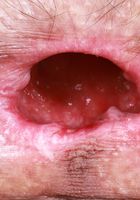 ATK Petites: Sia Wood (Sia Wood has an inviting hole or two)