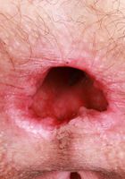 Sia Wood Gapes her Ass Wide, Sia Wood (sia004) ATK Natural & Hairy: Sia Wood (Sia Wood Gapes her Ass Wide)