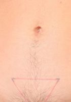 Hairy Stacey shows off her armpits, Stacey Stax (sta040) ATK Archives: Stacey Stax (Hairy Stacey shows off her armpits)